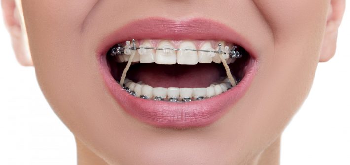 Ortodontia - Odontoclínica